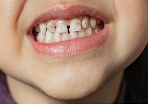 Before Image