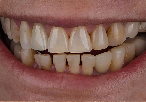 Before Image